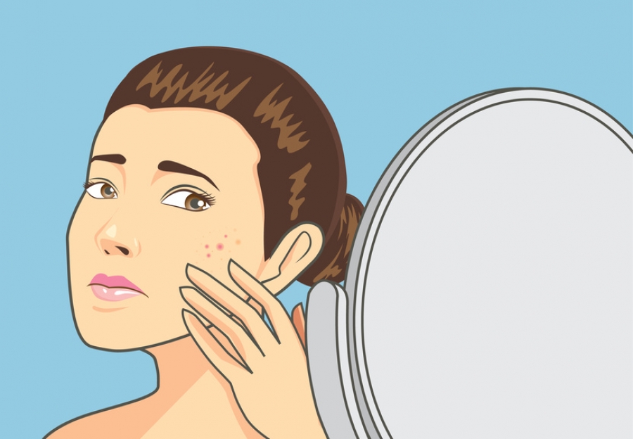 tratamento para pele com acne